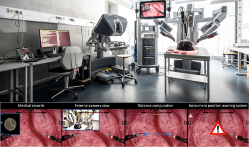 Design of Interactive Augmented Reality Functions for Robotic Surgery and Evaluation in Dry-Lab Lymphadenectomy