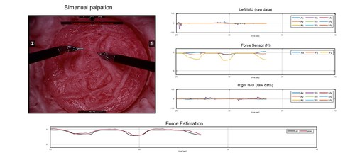 Learning to Estimate Palpation Forces in Robotic Surgery From Visual-Inertial Data